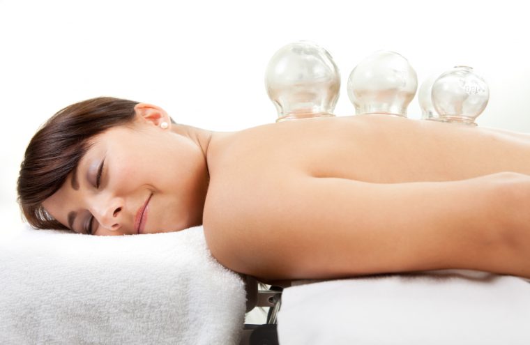 cupping