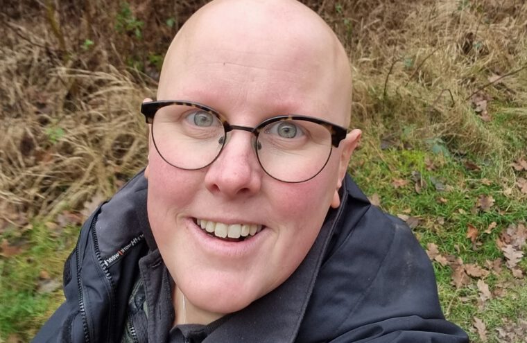 alopecia