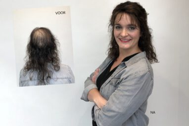 Haaraanvulling