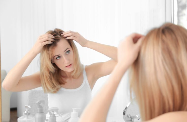 alopecia