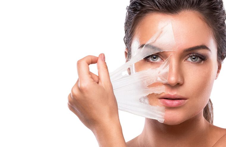 peeling