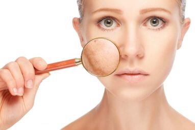 whitepeel