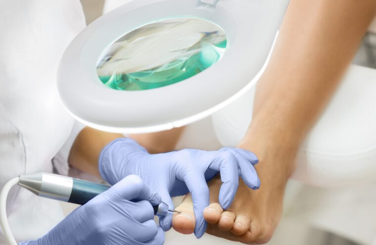 oncologische-voetverzorging
