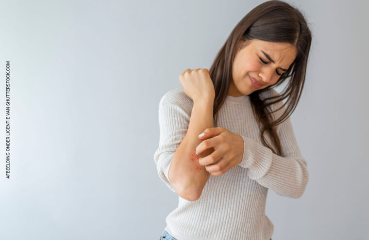 Eczeem